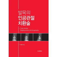 발목의 인공관절 치환술