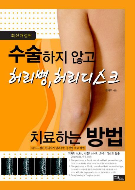 수술하지 않고 허리병 허리디스크 치료하는 방법(2009)