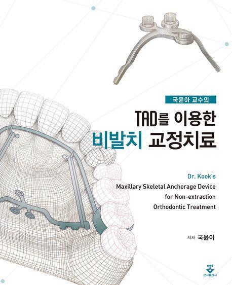 TAD를 이용한 비발치 교정치료